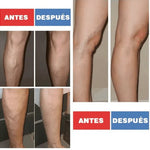 PARCHES PARA EL TRATAMIENTO DE VARICES